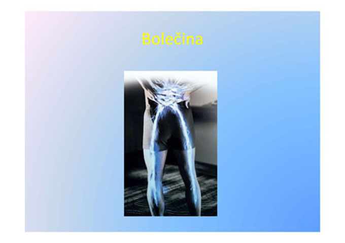 moje bolece noge Page 02