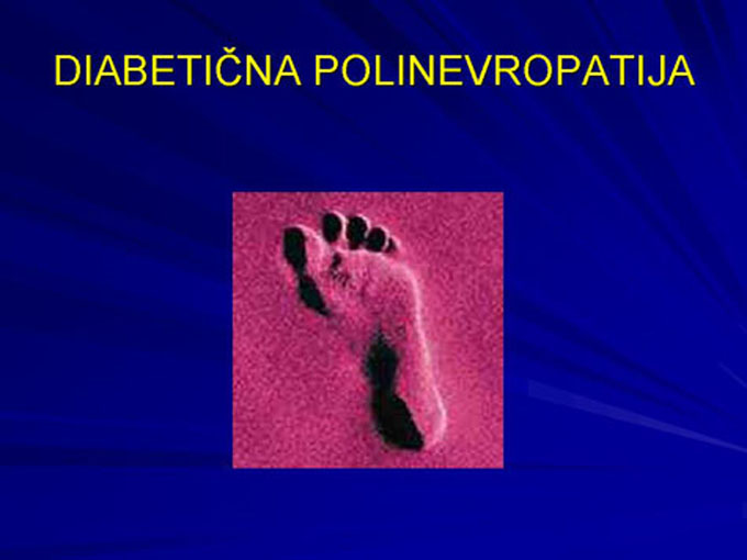 Diapozitiv7